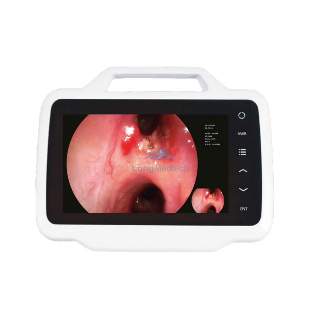 نظام التنظير الداخلي من سلسلة 200