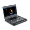 Doppler couleur portable Sonoscape X5