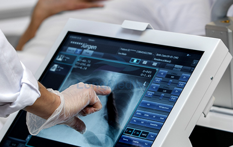 D&oacute;nde utilizar m&aacute;quinas de rayos X port&aacute;tiles.png