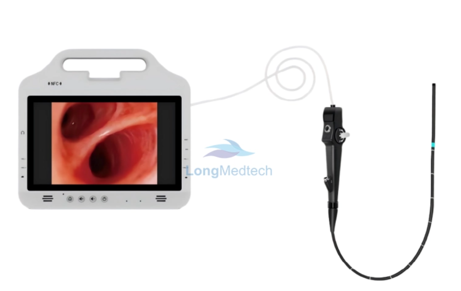 لماذا تحتاج كل عيادة إلى منظار الحنجرة بالفيديو