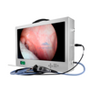 Sistema de c&aacute;mara para endoscopia port&aacute;til Full HD 1080P LOH-70/LOH-71