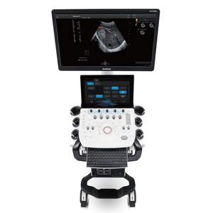 Doppler color con carro Sonoscape P25 Elite