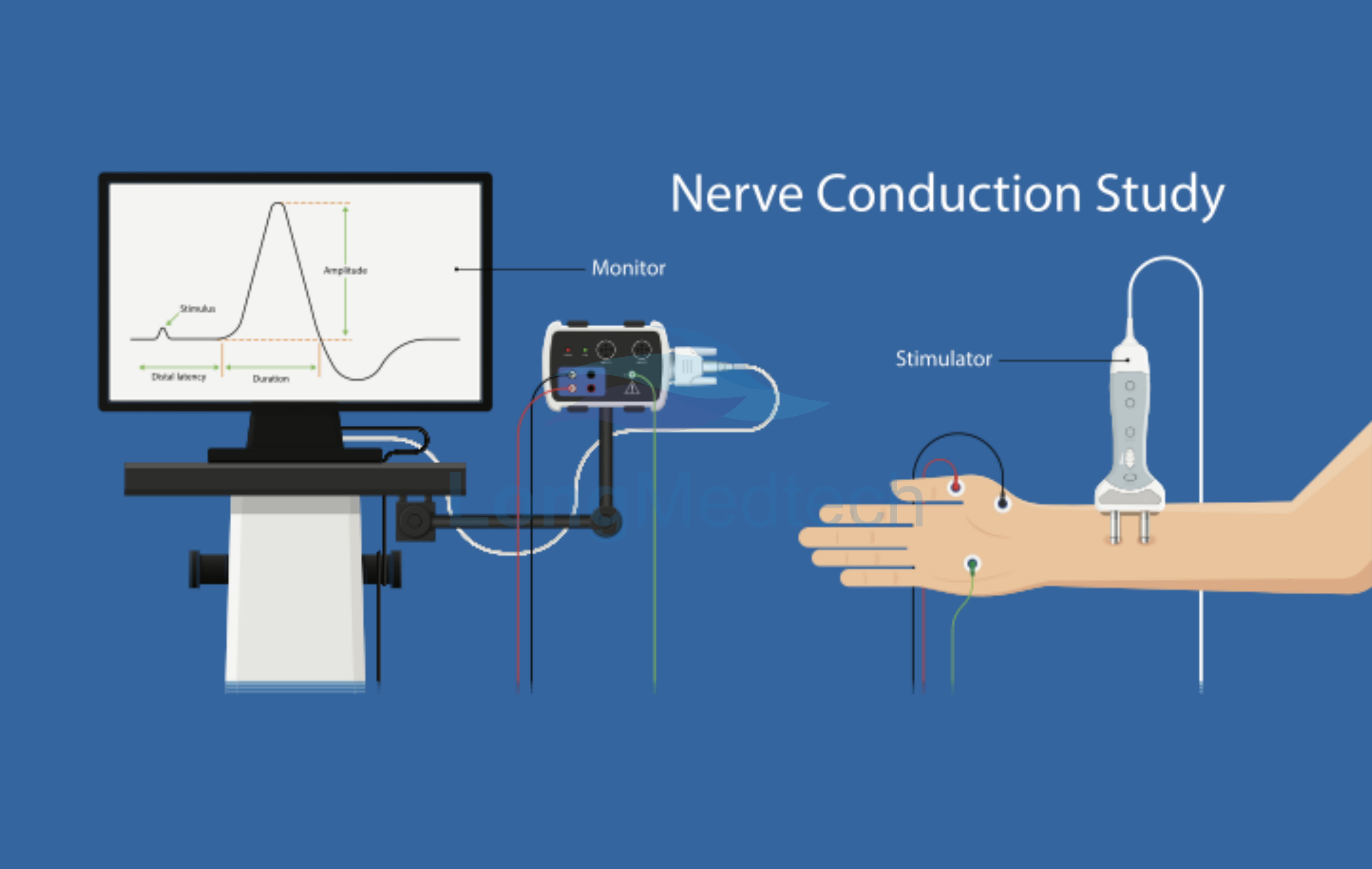 Та хэзээ EMG шинжилгээ хийх шаардлагатай вэ?