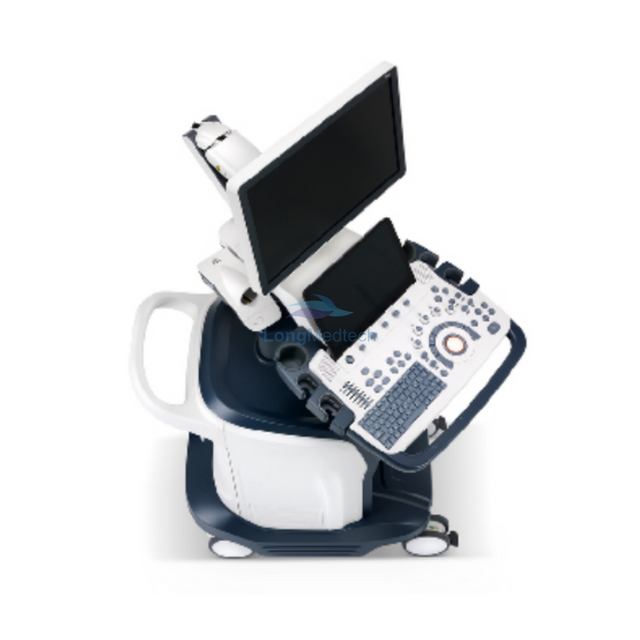 L'intelligence du SonoScape S60 en permet plus