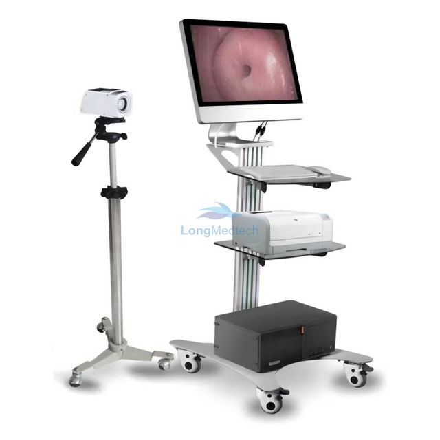 Colposcope &eacute;lectronique num&eacute;rique LSJ-300