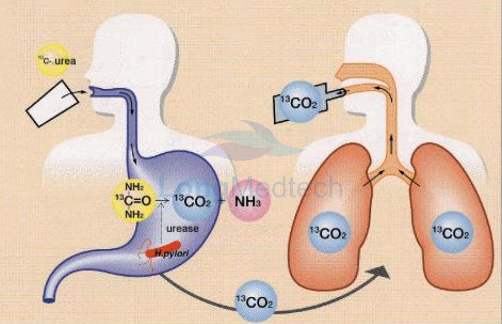 Manuel d'utilisation de l'analyseur d'haleine IR-force 13C